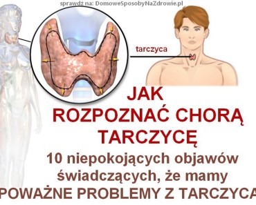 jak rozpoznać chorą tarczycę. Objawy