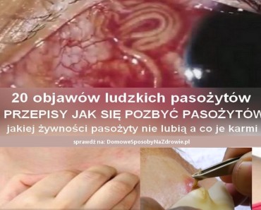 pasozyty-ludzkie-objawy-przepisy-jak-usunac-pasozyty