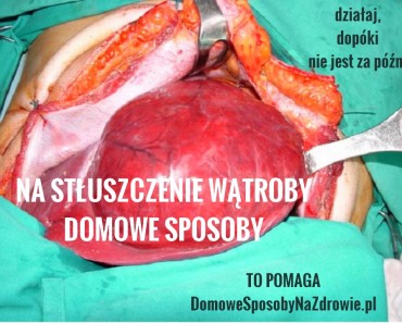domowesposobynazdrowie.pl-stluszczenie-watroby-domowe-sposoby