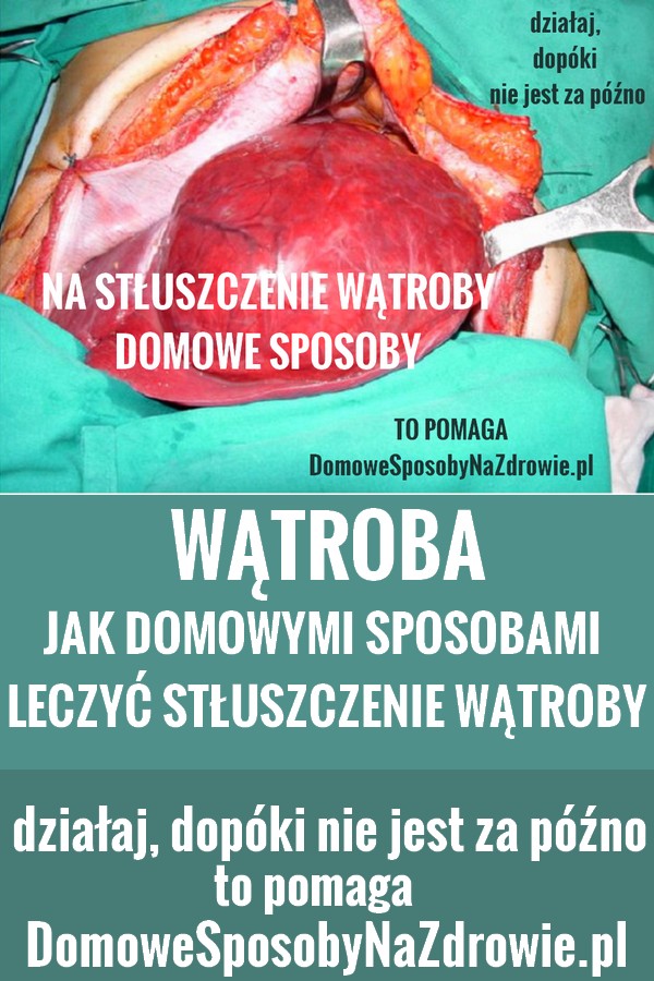 domowesposobynazdrowie.pl-stluszczenie-watroby-leczenie-naturalne-domowe-sposoby