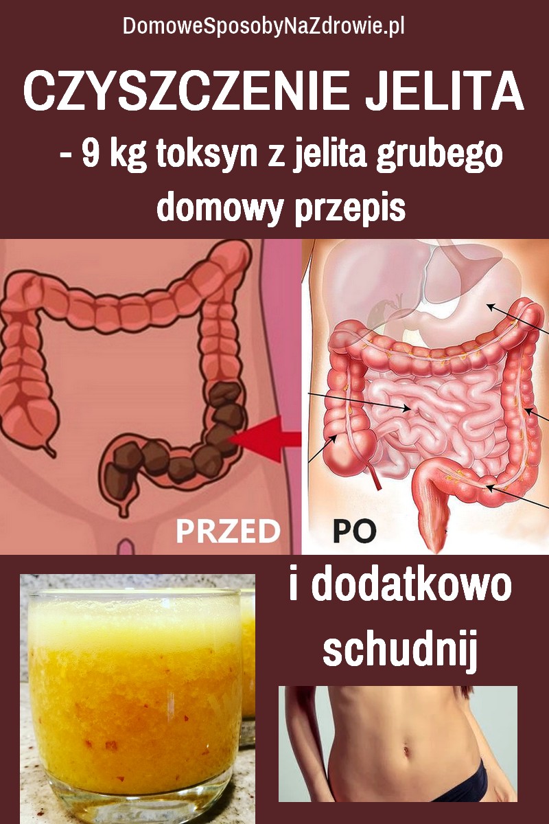 DomoweSposobyNaZdrowie.pl-czyszczenie-jelita-9-kg-mniej-przepis-domowe-sposoby